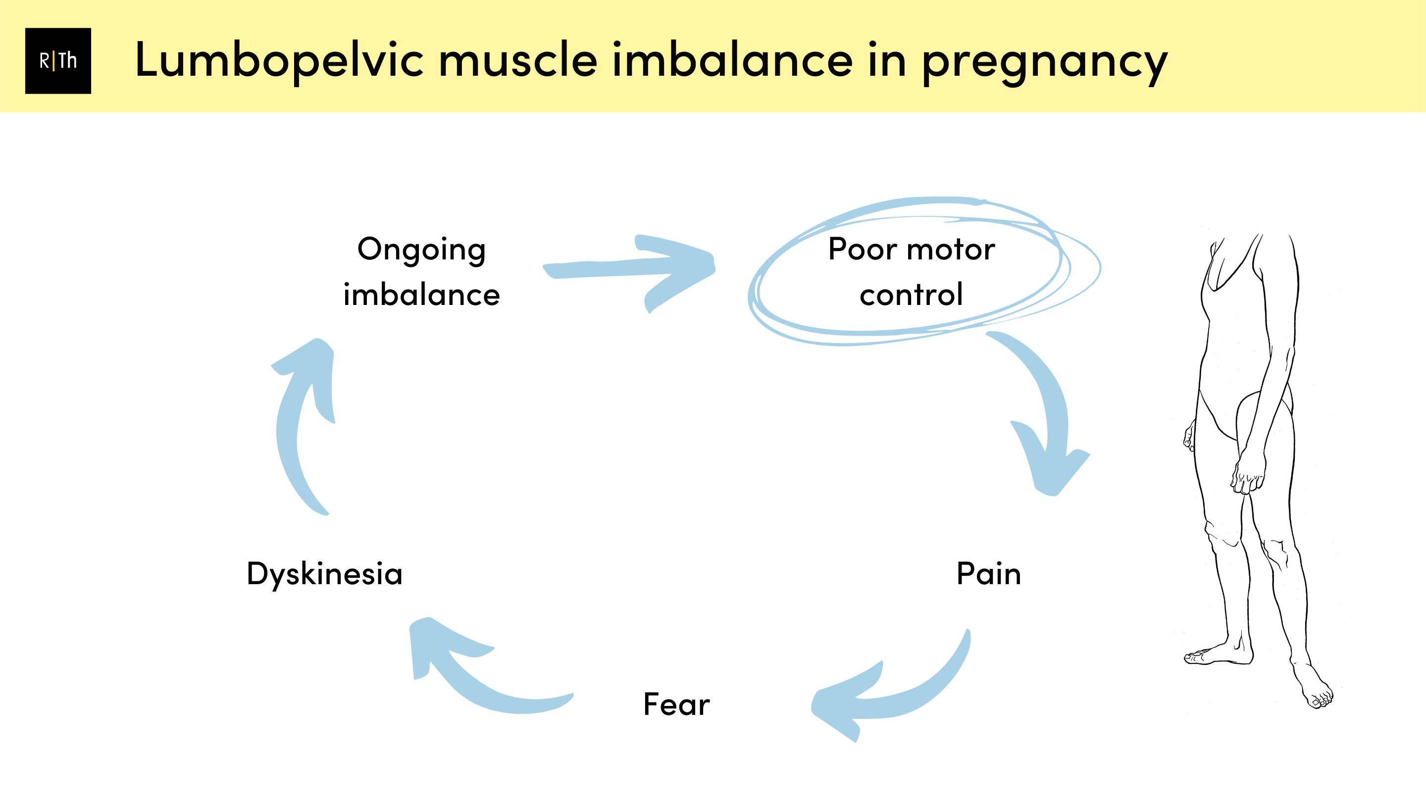 Pelvic Girdle Pain during pregnancy - Progressive care